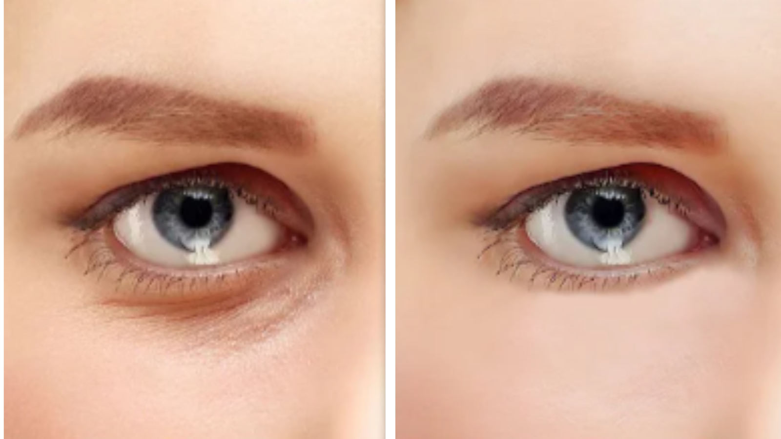 How to Prevent Makeup from Creasing Under the Eyes